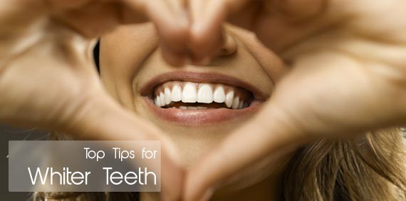 Top Tips for Whiter Teeth