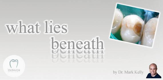 What Lies Beneath...