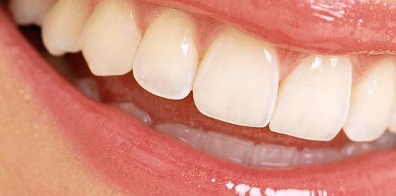 Beautiful Smiles Create Lasting Impressions