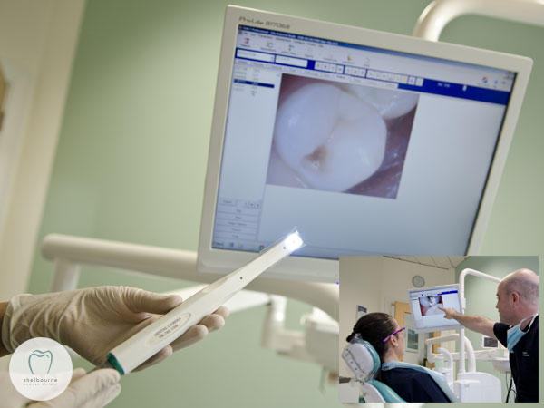 Using our intra-oral camera to show patients what we're seeing!