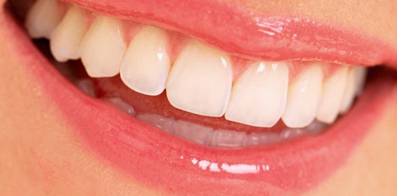 DIY Home teeth whitening ‘can cause permanent damage’