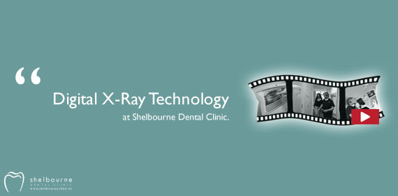 Video: Digital X-ray Technology at Shelbourne Dental Clinic Dublin