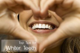 Top Tips for Whiter Teeth